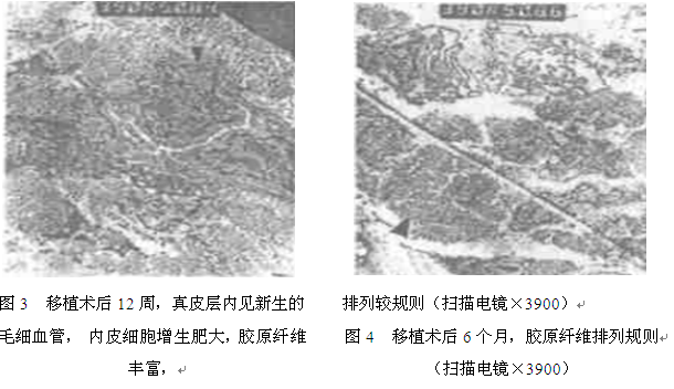 整形1