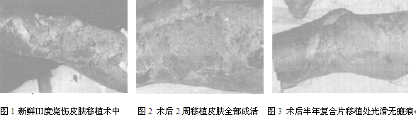 烧伤科1